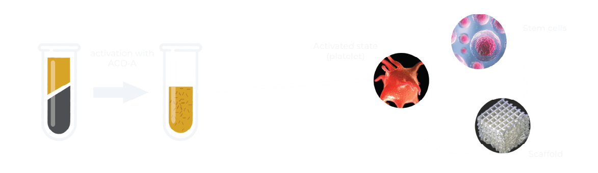 GLOW PRP activation diagram